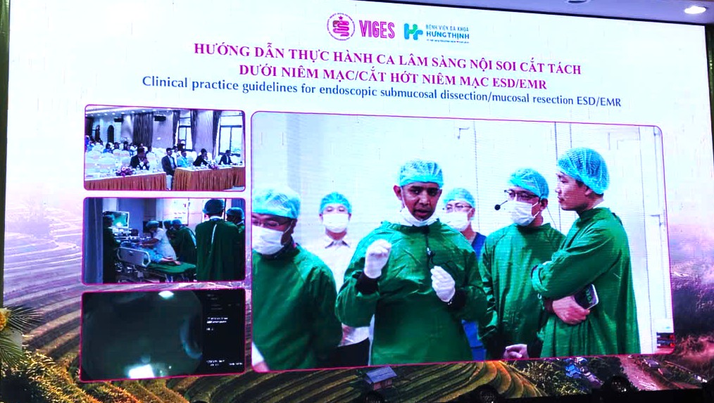Tiến Bộ Nội Soi Tiêu Hóa Can Thiệp: Tăng Cường Tiếp Cận Kỹ Thuật Hiện Đại