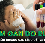 Người Đàn Ông Sống Cùng Ấu Trùng Sán Dây Đến 12 Năm: Một Câu Chuyện Cảnh Báo