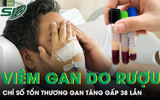 Người Đàn Ông Sống Cùng Ấu Trùng Sán Dây Đến 12 Năm: Một Câu Chuyện Cảnh Báo