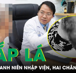 Khám Phá 3 Loại Cá Giá Rẻ Tăng Cường Dinh Dưỡng Tại Chợ Việt