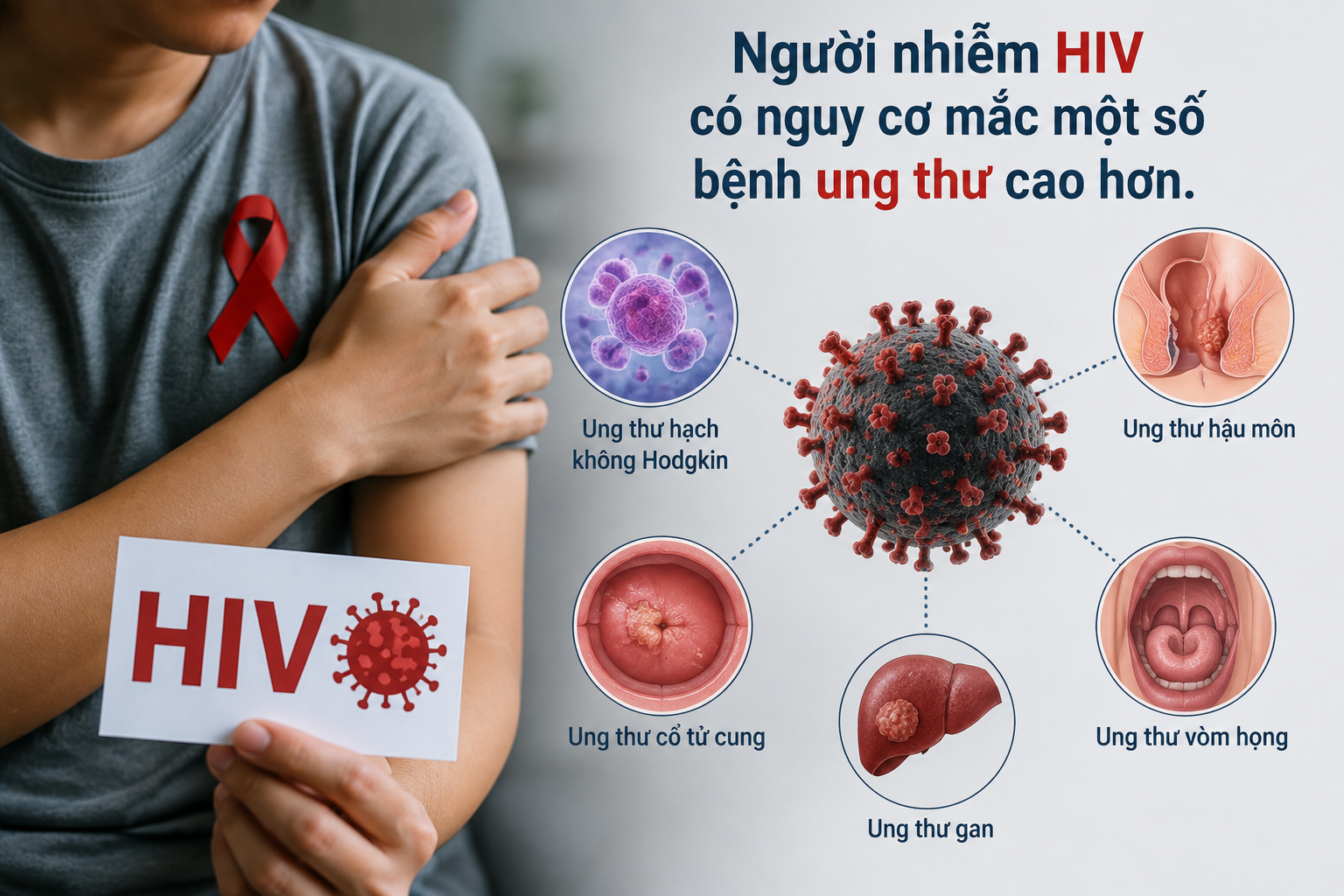 Người nhiễm HIV có cần tầm soát ung thư sớm hơn người bình thường? - Ảnh 1.