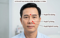 Khám Phá 5 Món Canh Củ Sen Dinh Dưỡng Dễ Chế Biến