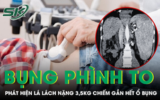 Câu Chuyện Cảnh Báo Sức Khỏe: Nam Sinh 18 Tuổi Bị Gan Nhiễm Mỡ Do Lối Sống Sai Lầm