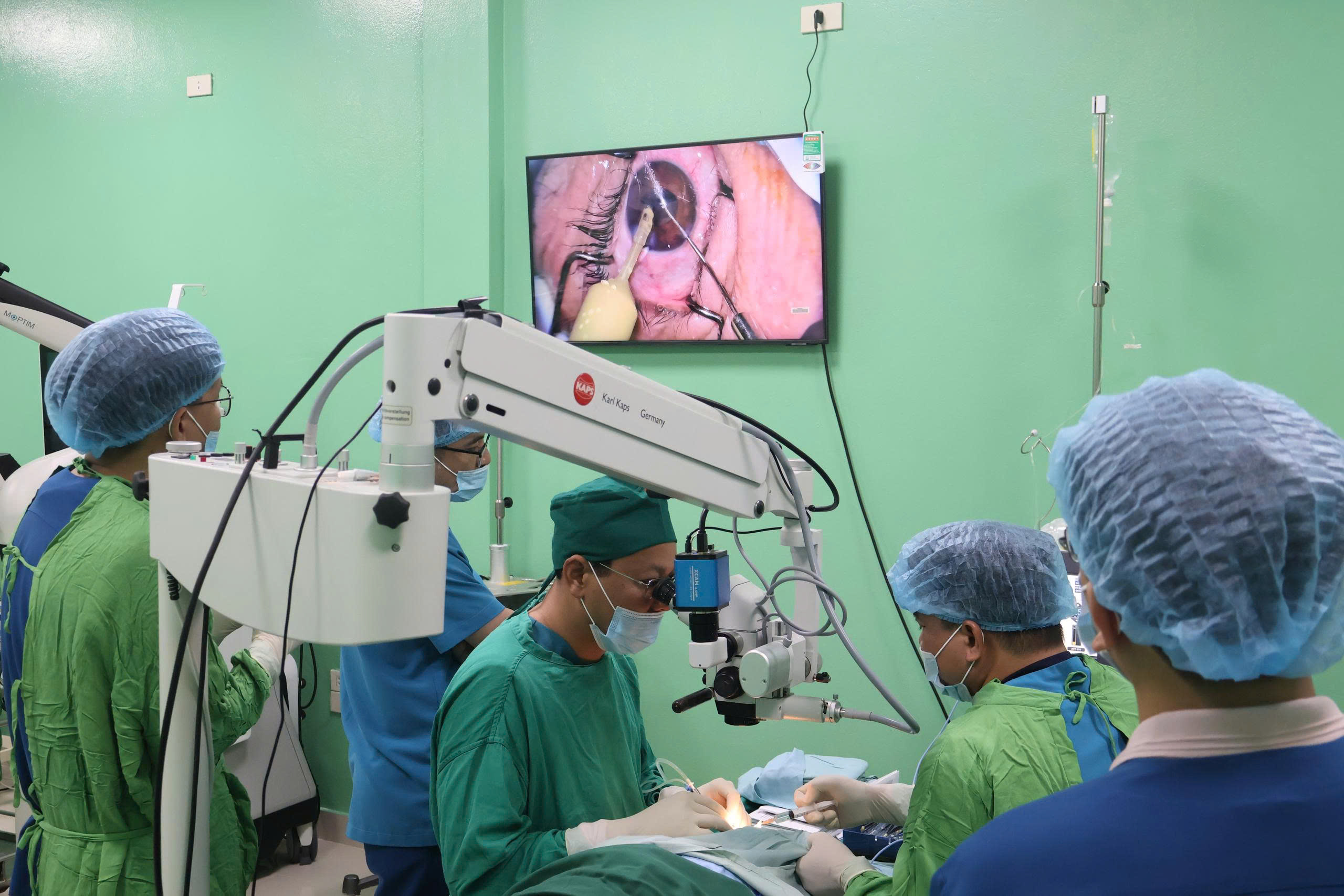 Thách thức chẩn đoán thoái hóa hoàng điểm tuổi già thể ướt giai đoạn sớm- Ảnh 2.