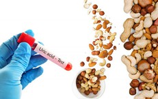 Giải Pháp Vận Động Hiệu Quả Để Ngăn Ngừa Béo Phì Và Đái Tháo Đường Ở Trẻ Em