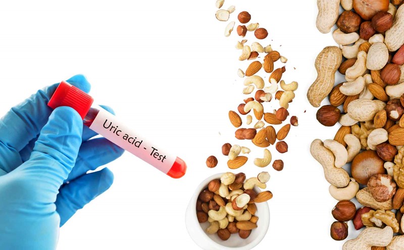 Những Thói Quen Ảnh Hưởng Đến Mức Acid Uric Của Bạn