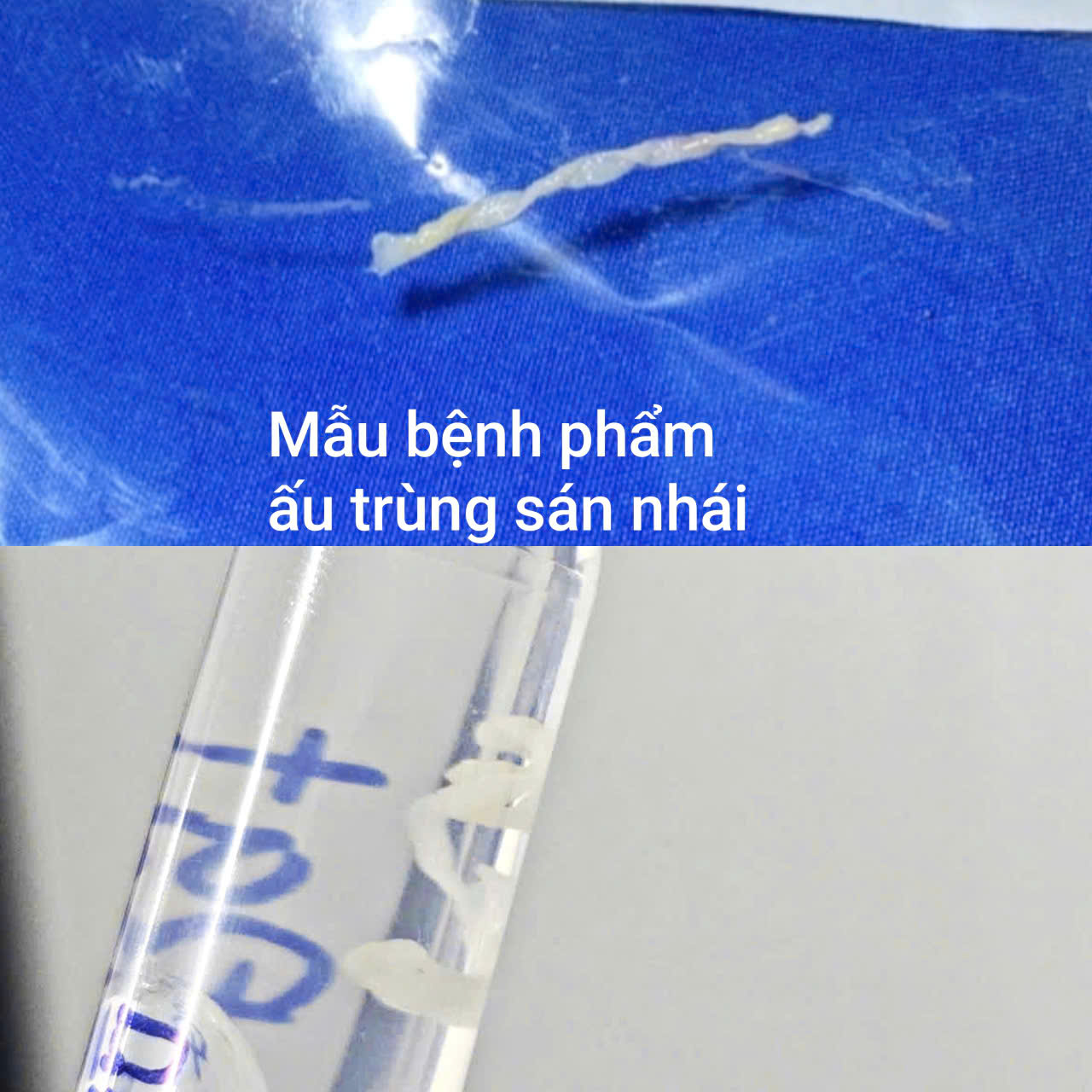 au-trung-san-nhai-17866090457232125237772 Nguy Cơ Bệnh Tật Từ Việc Uống Nước Suối Không An Toàn Khi Bơi - Ảnh 2.