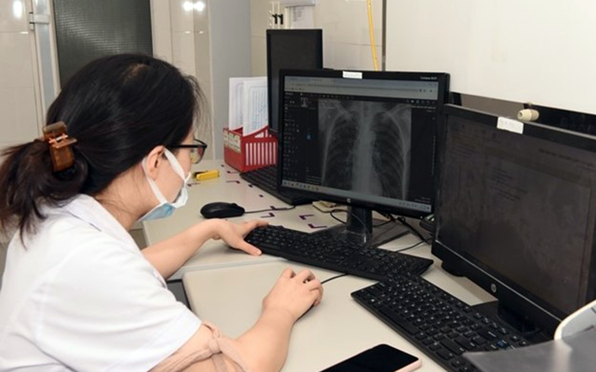 Khẩn Trương Thực Hiện Phê Duyệt Giá Dịch Vụ Chẩn Đoán Hình Ảnh Sử Dụng PACS