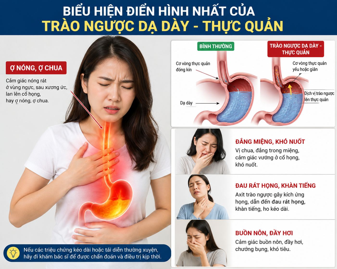 bd1c032a-fe54-4a60-8c09-f3fdf28330a5-1785570449562400036781 Bệnh trào ngược dạ dày - Thực quản có thể nhận biết sớm và chủ động phòng ngừa - Ảnh 2.