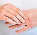 Khám Phá Tuổi Thọ Của Người Nhiễm HIV Trong Thế Giới Hiện Đại