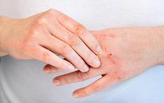 Khám Phá Tuổi Thọ Của Người Nhiễm HIV Trong Thế Giới Hiện Đại