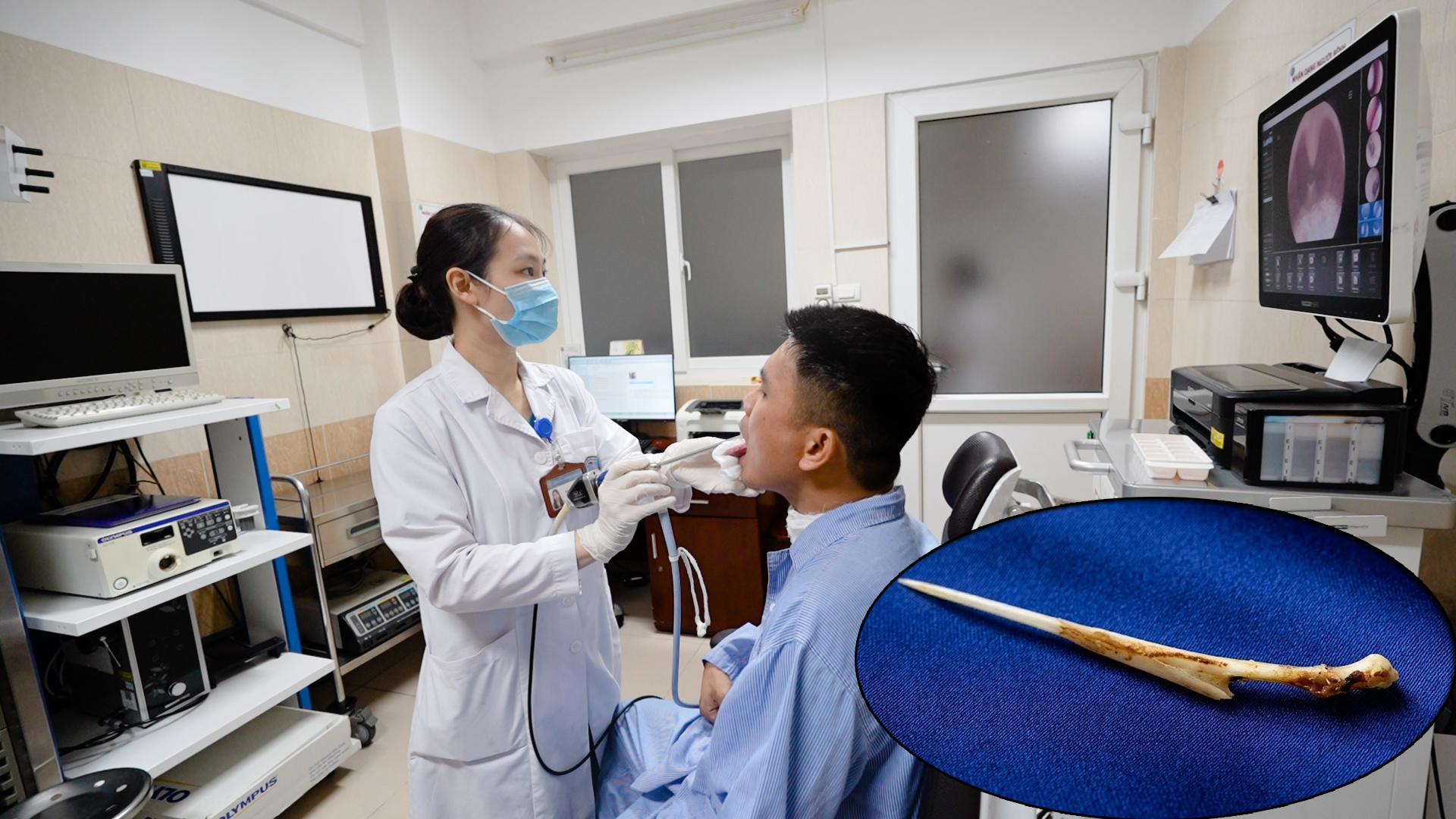 Câu Chuyện Cảnh Giác Về Hóc Xương: Từ Khổ Nạn Đến Bài Học