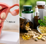 Những Thực Phẩm Bổ Sung Cần Tránh Khi Dùng Canxi