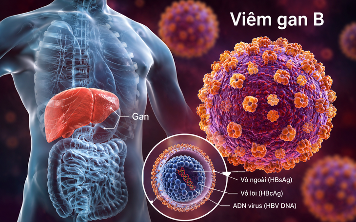 Vì sao viêm gan B và C vẫn gây tử vong dù đã vắc xin và thuốc điều trị? - Ảnh 2.