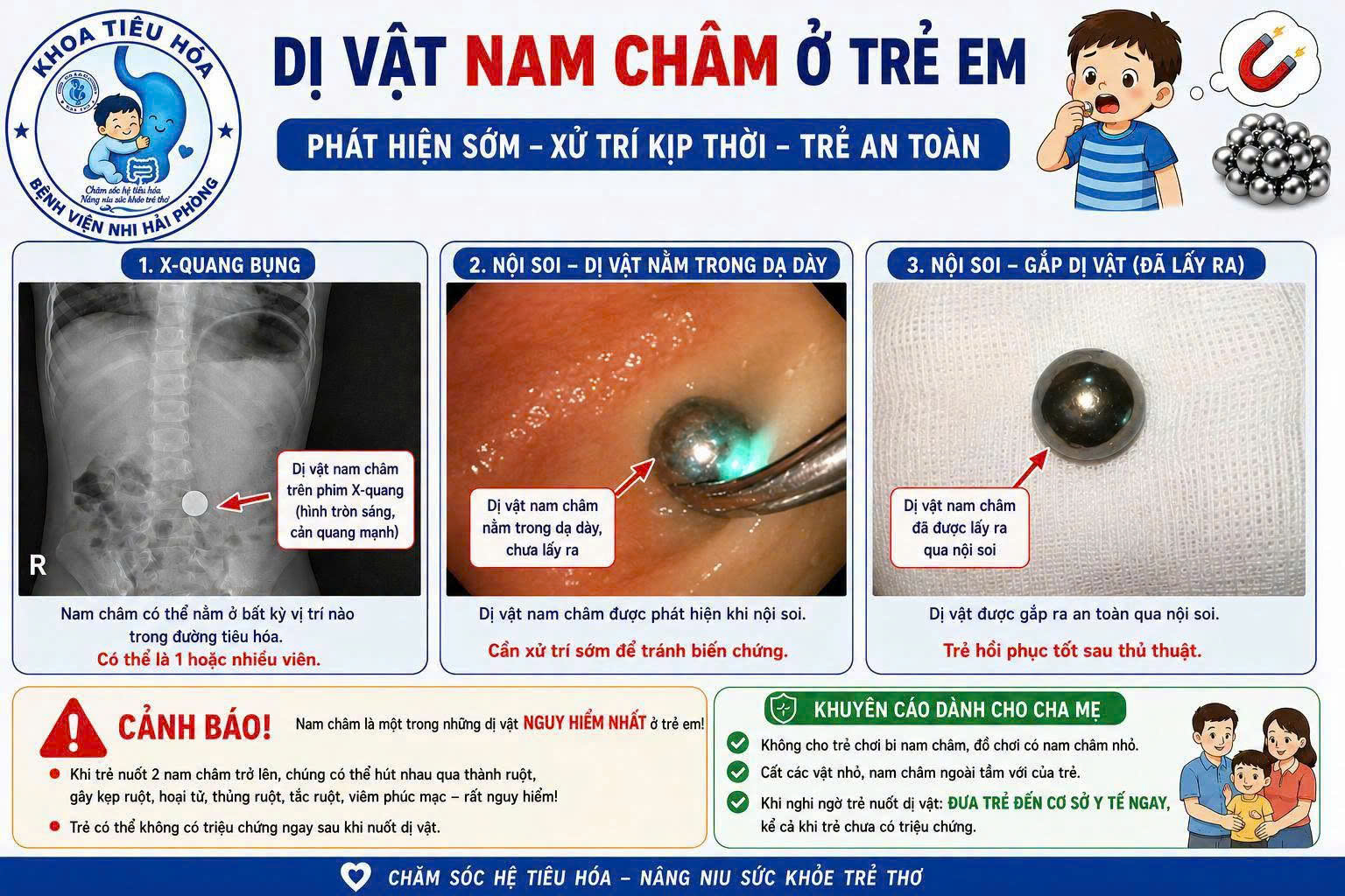 Nguy Cơ Từ Việc Trẻ Nuốt Phải Bi Nam Châm Và Cách Xử Lý Kịp Thời