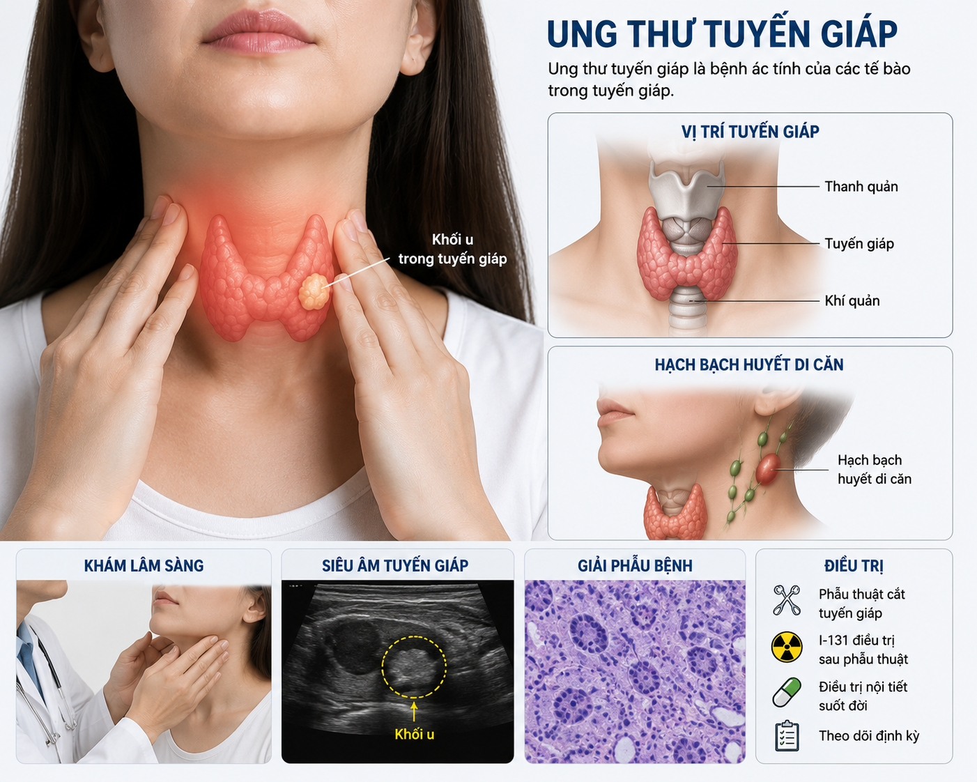 Ai Cần Điều Trị I-131 Sau Khi Mổ Ung Thư Tuyến Giáp? - Ảnh 1.