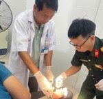 Tình Hình Dịch Bệnh Tay Chân Miệng và Sốt Xuất Huyết Tại Lâm Đồng: Cảnh Báo Khẩn Cấp