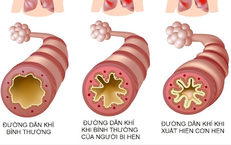 Những Dấu Hiệu Cần Theo Dõi Khi Trẻ Sặc Nước: Cách Ứng Phó Khẩn Cấp