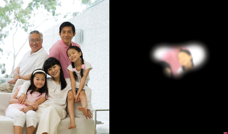 Bệnh Glaucoma: Nguy Cơ Mất Thị Lực và Giải Pháp Điều Trị Hiện Đại