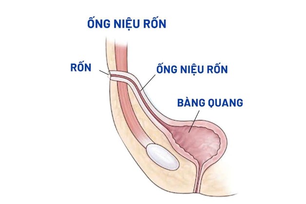 picture3-1786074742138740013067 - Ảnh 3.