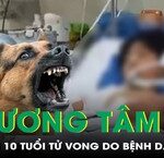 Mối Nguy Hiểm Từ Viêm Ruột Thừa: Câu Chuyện Cấp Cứu Ba Em Nhỏ