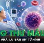 Cảnh Báo Về Những Nguy Cơ Khi Bị Đá Dừa Rơi Trúng Mắt