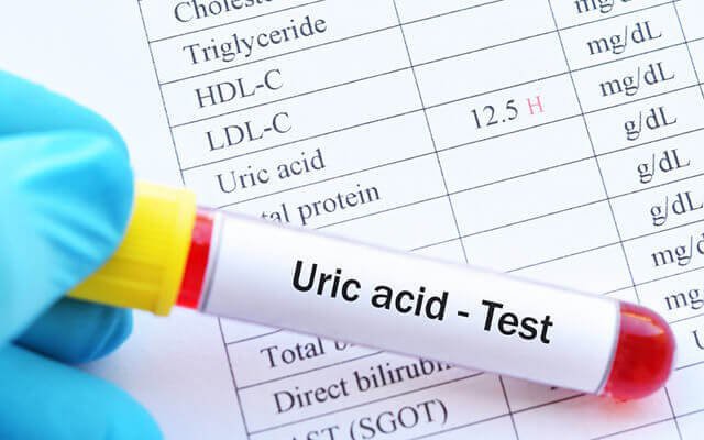 Tác Động Của Nước Chanh Mật Ong Đến Acid Uric - Ảnh 3.