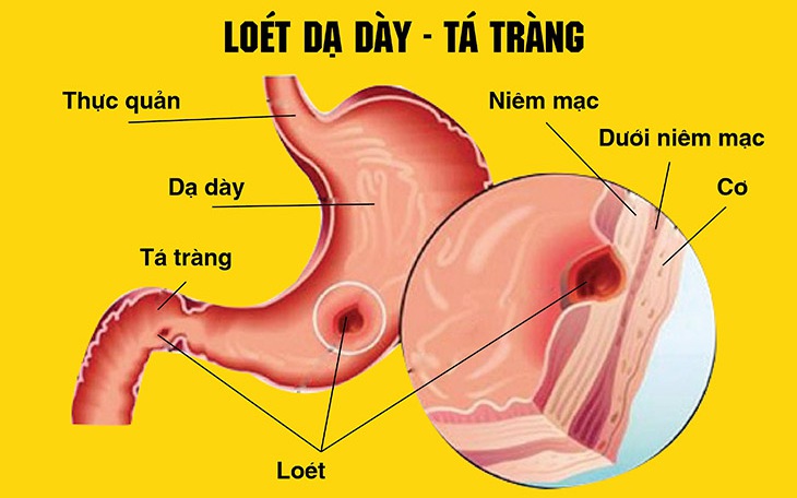 Những Công Dụng Chữa Bệnh Đáng Ngạc Nhiên Của Cây Xấu Hổ
