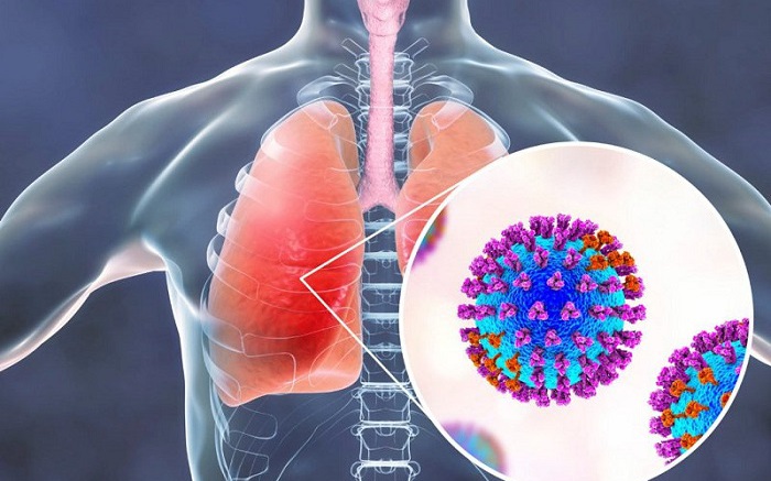 Hiểu Về Viêm Phổi Do Adenovirus Ở Trẻ: Triệu Chứng và Biện Pháp Phòng Ngừa