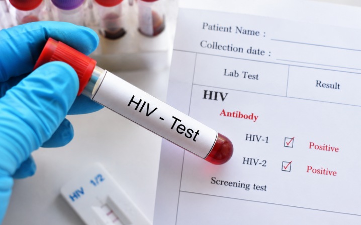 HIV chưa có thuốc chữa khỏi nhưng đã có thể kiểm soát như một bệnh mạn tính - Ảnh 2.