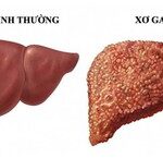Những Tác Động Của Ca Đêm Đến Sức Khỏe Và Giải Pháp Khắc Phục