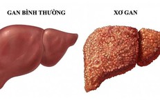 Những Tác Động Của Ca Đêm Đến Sức Khỏe Và Giải Pháp Khắc Phục