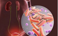 Phát Hiện Sớm Bệnh Nghề Nghiệp: Những Giai Đoạn Quan Trọng Cần Biết