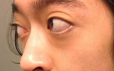 Lưu Ý Quan Trọng Về Sử Dụng Thuốc Cường Dương Cho Người Bệnh Tim